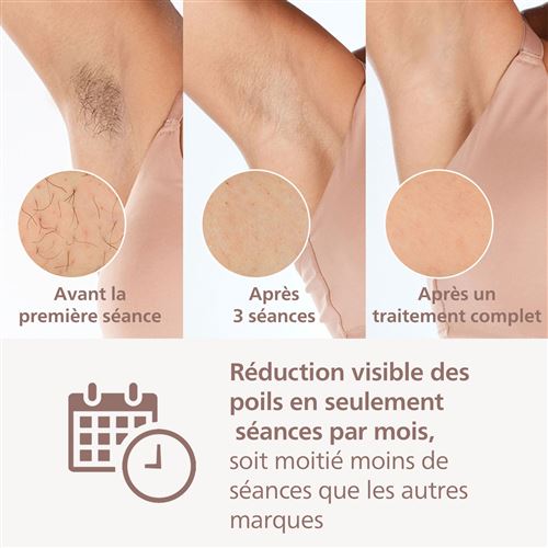 Philips Lumea Series 9900 IPL Hair Removal Device BRI951/01